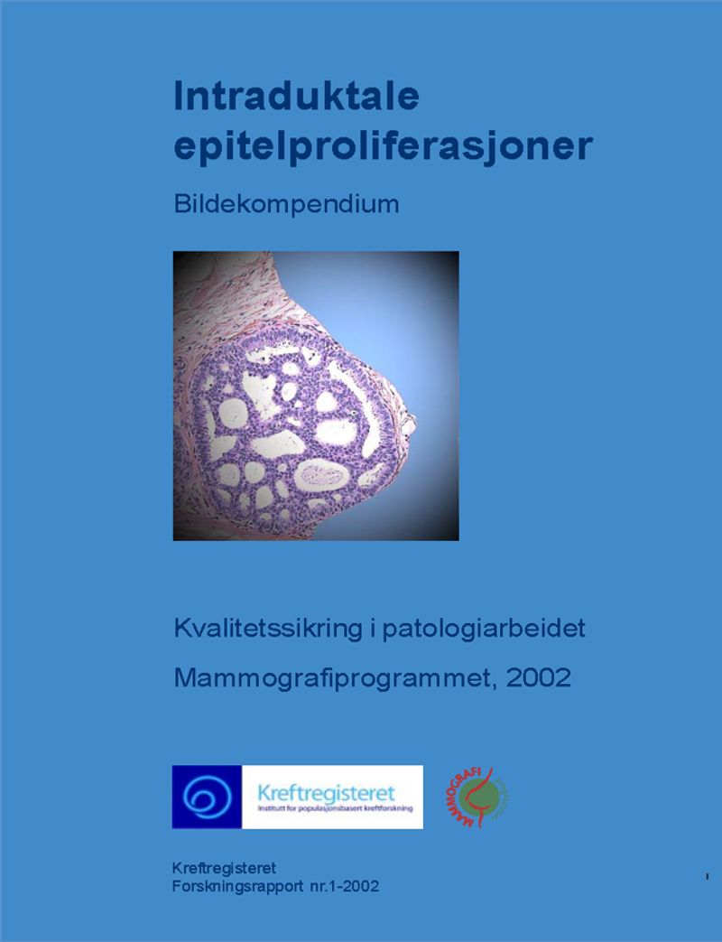 Forside Intraduktale epitelproliferasjoner