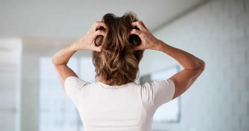 Woman Scratching Dry Itchy Scalp With Long Hair. Kvinne sett bakfra, med halvlangt hår, klør seg med begge hender i hodebunnen.