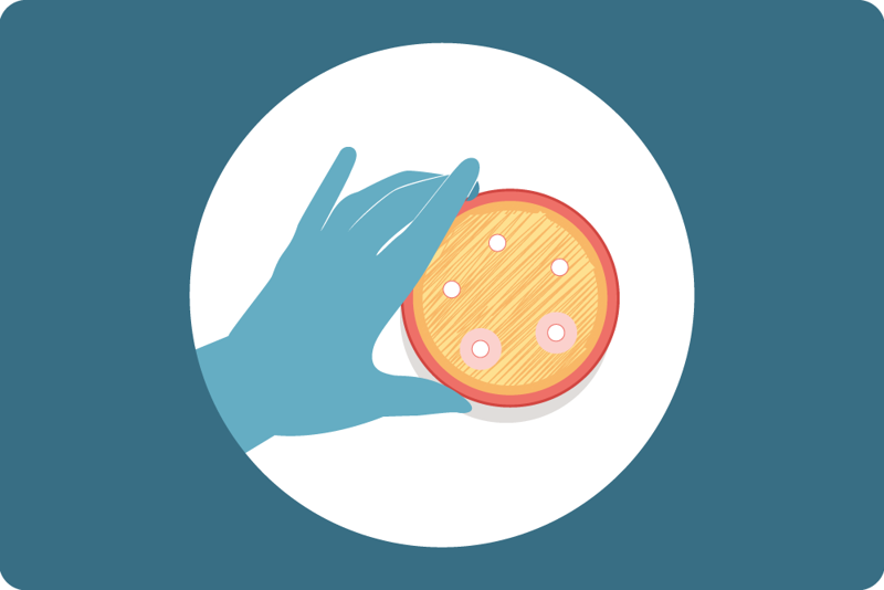 hånd med hanske som holder i en petriskål med bakterier