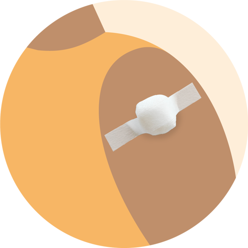 Illustrasjon av arm med plasterlapp - versjon 2