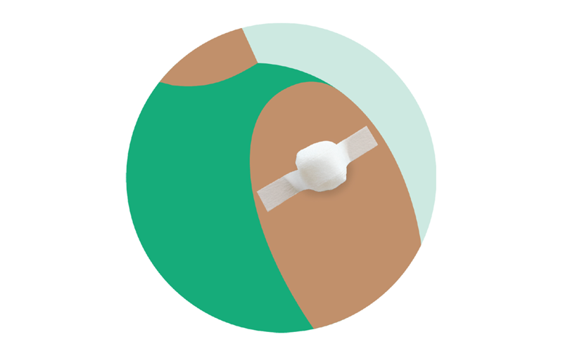 illustrasjon av en arm med plasterlapp