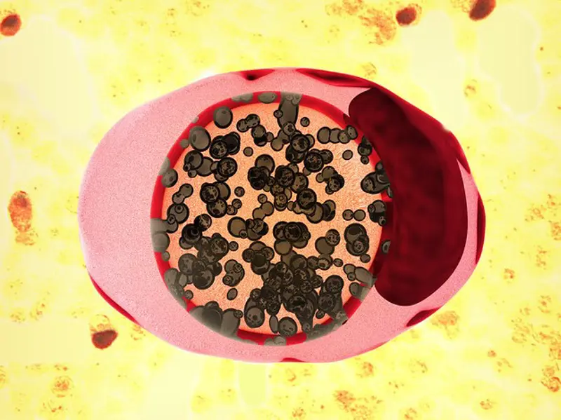 Illustrasjon av klamydia virus.