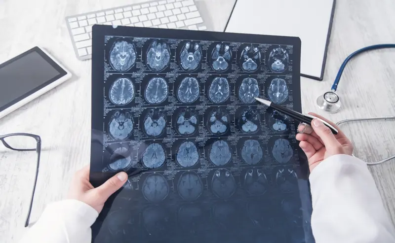 Hjernen, kreft, lege