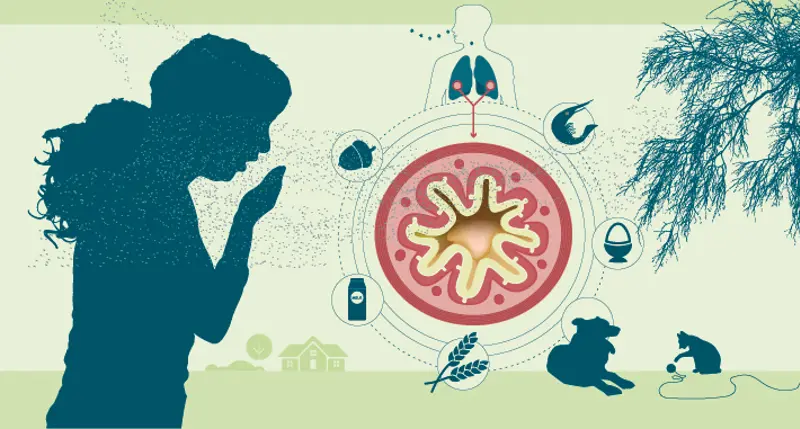 Astma og allergi er en hyppig årsak til plager hos barn og unge i industrialiserte land. Allergener og irritanter kan skape hevelse i slimhinnene og gjøre at det blir tyngre å puste  Illustrasjon: Folkehelseinstituttet/Fetetyper.no