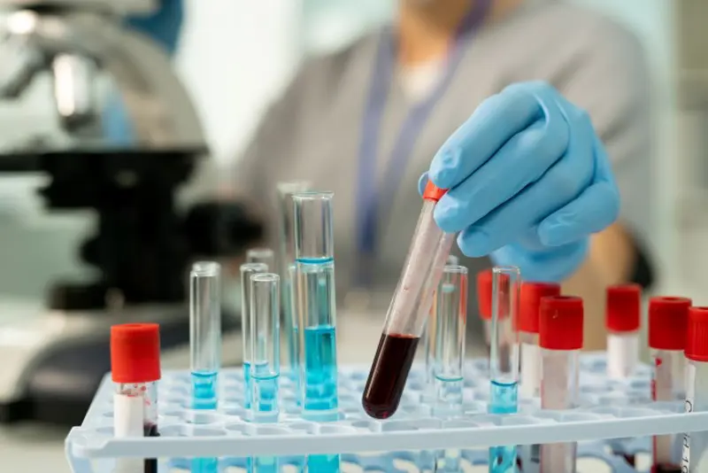 en dame holder opp et av flere reagensrør med blod