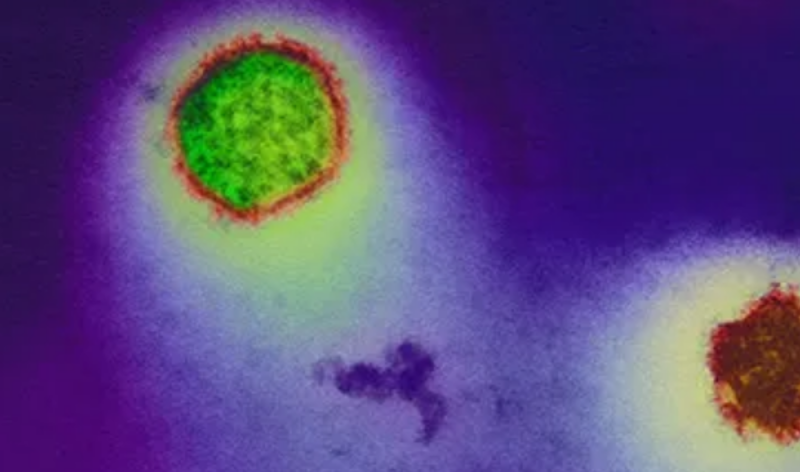 Hantavirus.