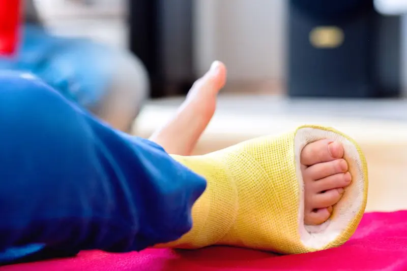 illustrasjonsbilde av et barnebein med gul gips