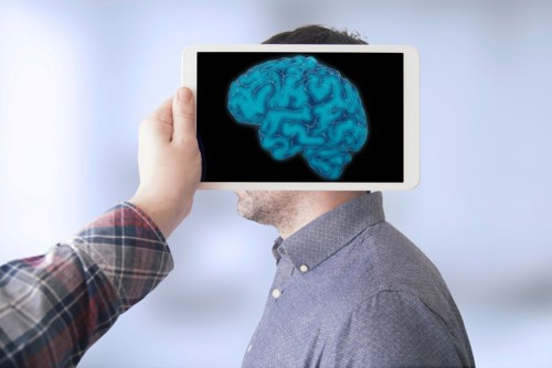 Illustration of a brain scan