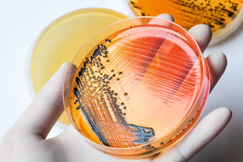 salmonellabakterier i en petriskål