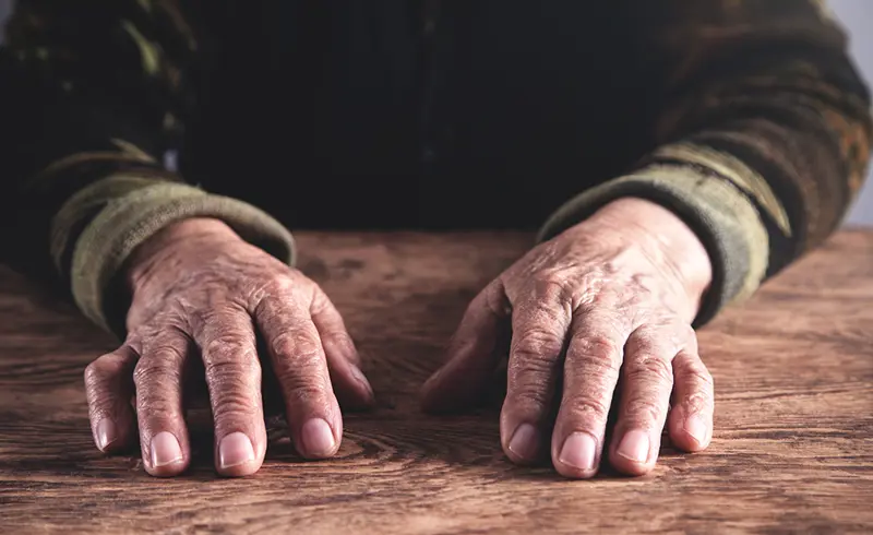 Håndartrose Colourbox.com