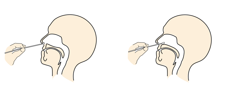 Fremre neseprøve. Illustrasjon: Folkehelseinstituttet 