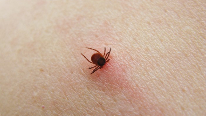 Ticks and tick-borne diseases