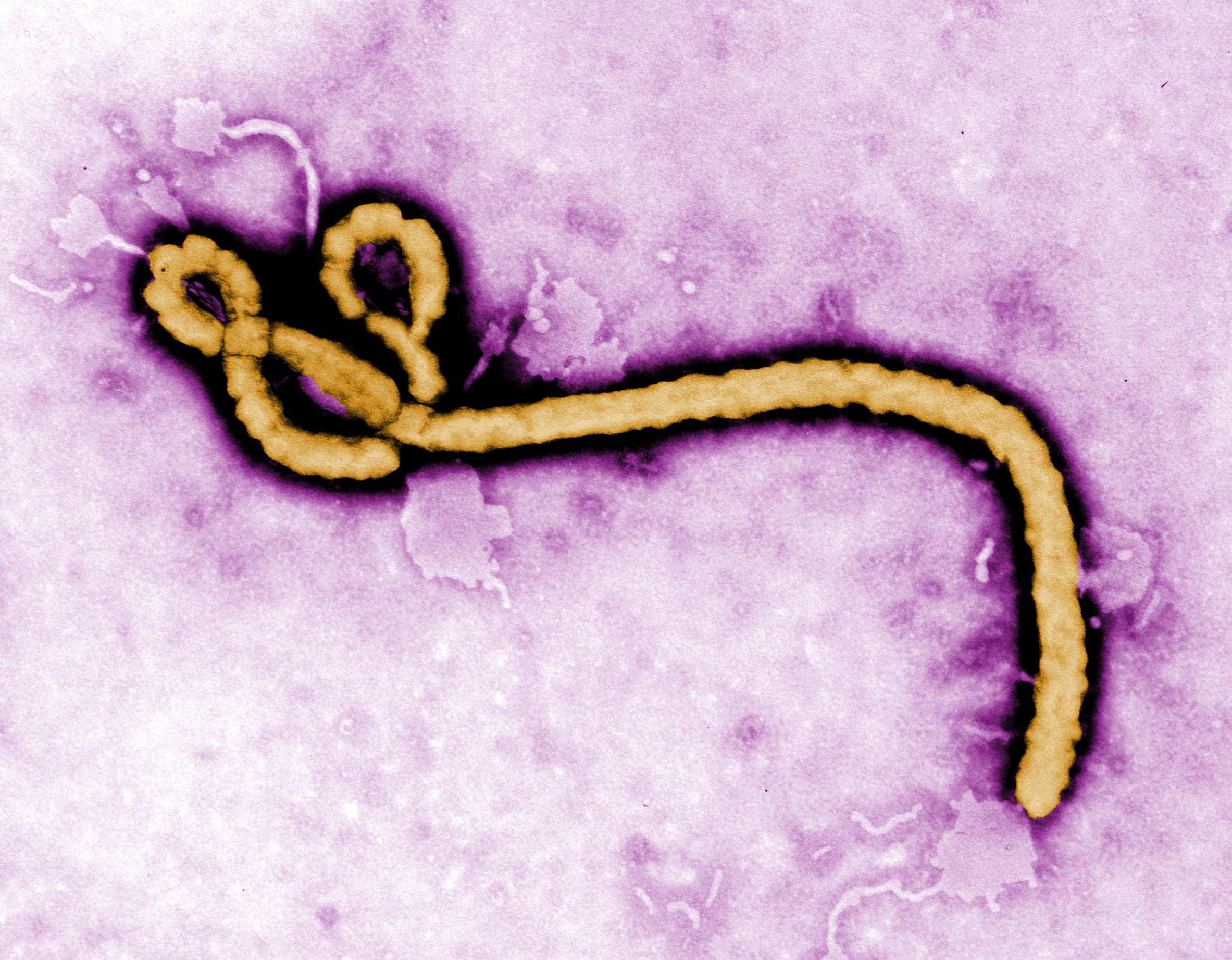 ebolavirus.  Frederick Murphy / CDC