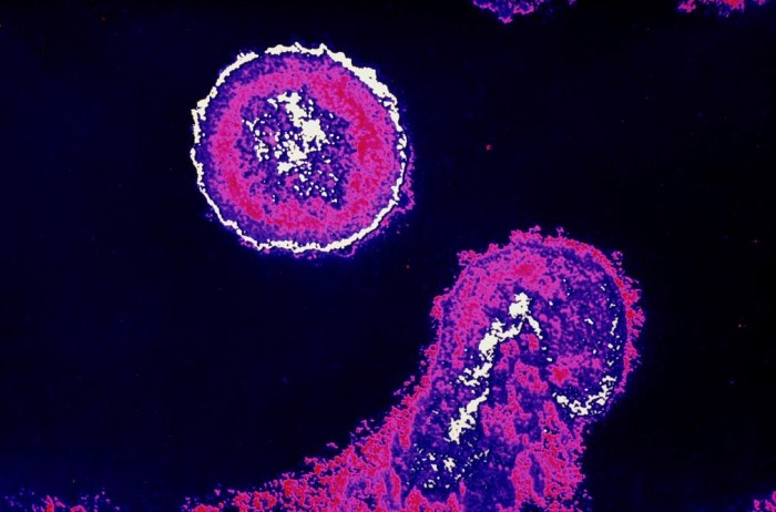 Hivvirus i mikroskop2.jpg