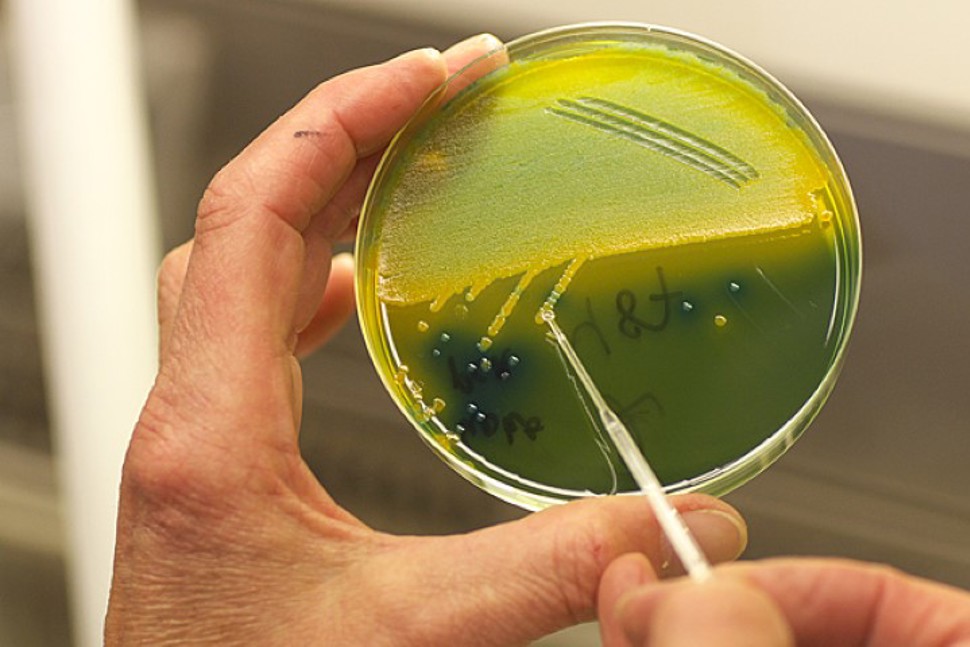 Bakteriekultur dyrking FHIt