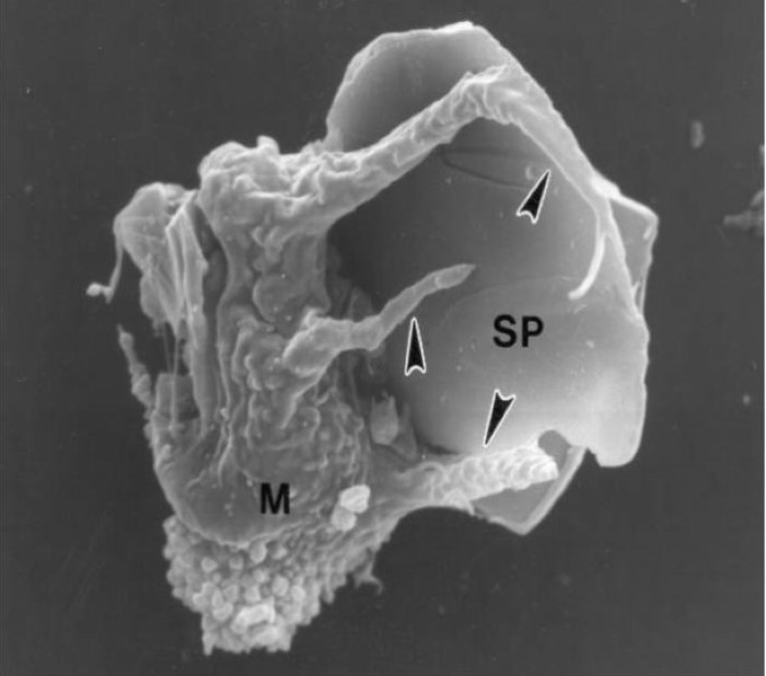 Elektronmikroskopisk bilde av en makrofag (M) i ferd med å ta opp en silikapartikkel (SP). Bildebredde = 24 mµ. . Ellen Namork, FHI