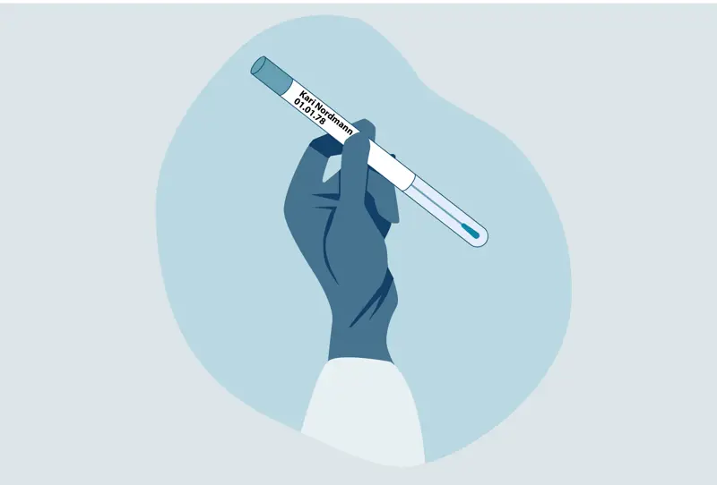 Hånd som holder en HPV hjemmetest